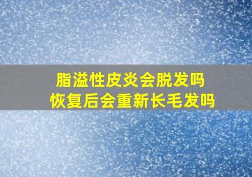 脂溢性皮炎会脱发吗 恢复后会重新长毛发吗